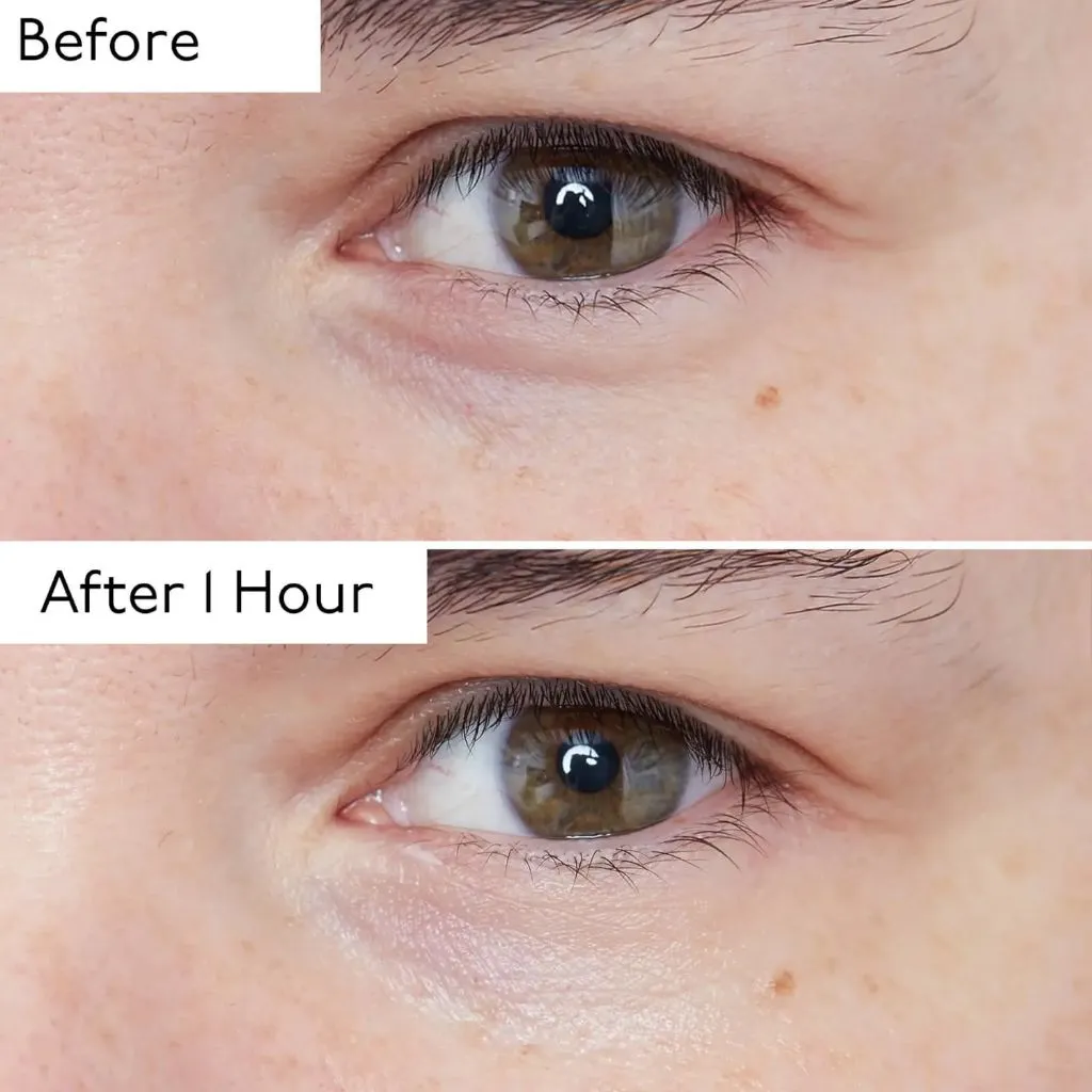 By Terry Hyaluronic Global Eye Serum