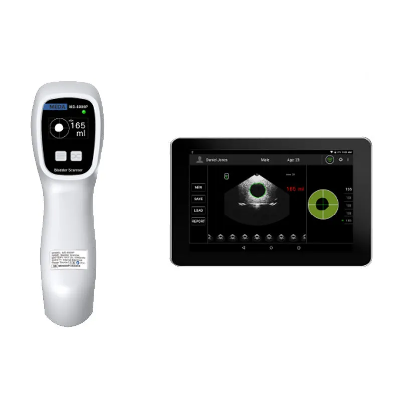MD6000-Pro Bladder Scanner – Hand-held